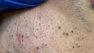 Maya Deep Cleansing Techniques (For Clear, Glowing Skin)