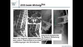 Video dynamische Stabilisierung