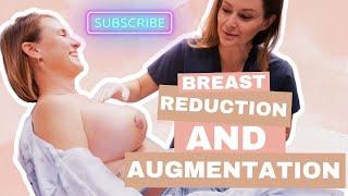 Life-Changing Results: My BRA Procedure Journey with Dr. Caridi