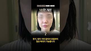 [실리프팅] 30대 얼굴 처짐, 실리프팅으로 해결! | #팔자주름 #실리프팅 #피부관리