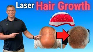 Laser Hair Growth Therapy for Male and Female Hair loss