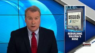 Nasal reconstruction on WNDU - Dr. Joshua Lampert