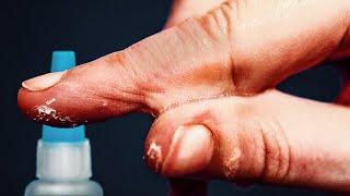 Why Super Glue Is Perfect For Gluing Skin