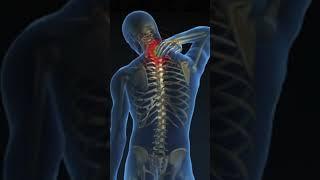 PERSISTENT RHOMBOID PAIN.  BEST Exercises & Stretches