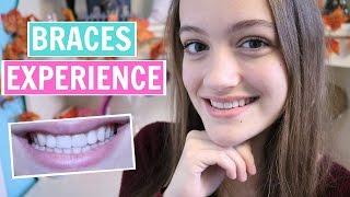 My Braces Experience + Tips & My Advice!