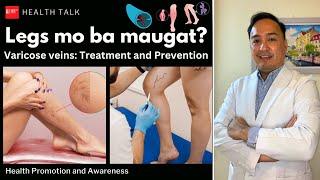 Legs mo ba maugat? Varicose veins: Treatment and Prevention