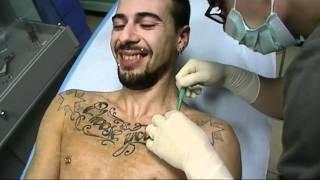 Alle Tattoo - Microdermal