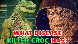 Killer Croc Anatomy - Can Killer Croc Have A Baby? How He Became Like This? & Other Q's Answered