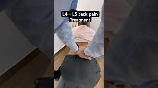 L4 - L5 back pain treatment by dr harish grover