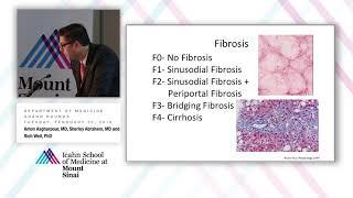 Non-alcoholic Fatty Liver Disease