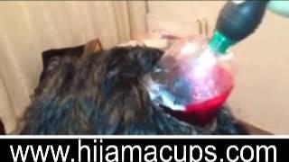 Hijama Lesson 3 الحجامه  Part 2 3 Cupping The Patience Head Without Shaving