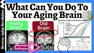 What Can You Do To YOUR AGING BRAIN? 12 Ways To Keep Your Brain YOUNG & New Advances