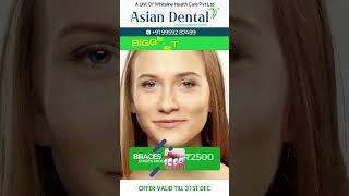 Best Braces Treatment | Dental Braces Offer |  Asian Dental | Vijayawada | Hyderabad