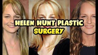 Helen Hunt Plastic Surgery