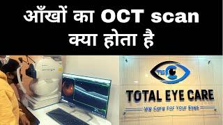 Eye Ka OCT scan kya hota hai| Total Eye Care| Kolkata