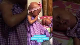 72 #progeria #irmagemeas #eliseeloa #criancasespeciais #fyp #eloa #elis #happyfamily #love