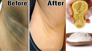 Baking Soda for Underarm Whitening - Dark Underarms Home Remedy