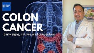 Colon Cancer: Early signs, causes and prevention