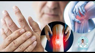 CUDURKA UGU BADAN EE KALAGOOSYADA KU DHACO(RHEMATOID ARTHRITIS)