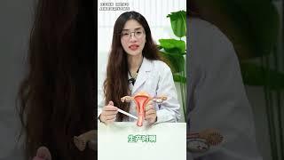 陰道里面的皺褶，可不是擺設！#硬核健康科普行動