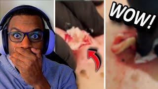 BEST CYST POPS OF 2025?!