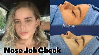 I GOT A NOSE JOB | Yaslen Clemente