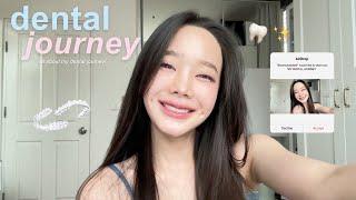 my DENTAL JOURNEY  | เล่าประสบการ์ณทำฟันทั้งหมดของบีม, clear aligners, กรอฟัน | BEAMSAREEDA