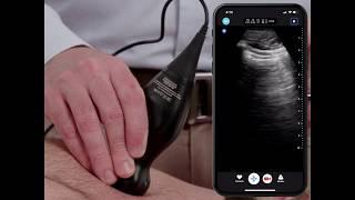 Ultrasound Education: Basic Lung Scanning Technique