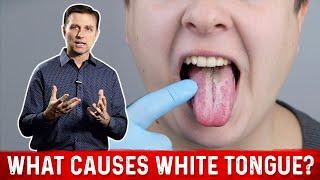 What Causes White Tongue? – Dr.Berg on Oral Candidiasis