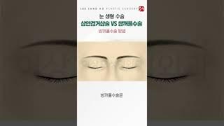 상안검거상술 vs 쌍꺼풀수술 무슨 차이점?