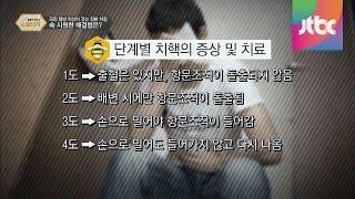 국민 절반 이상이 겪는 '치질' 속 시원한 해결법 달콤한 정보쇼 꿀단지 15회