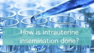 How is intrauterine insemination done?