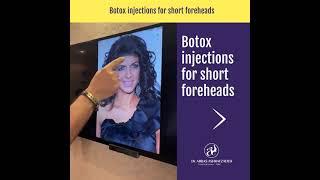 botox injection for short forehead #botoxinjection #botoxtechniques #filler