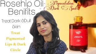 Vrikshveda Rosehip Oil Benifits , Uses Review || 