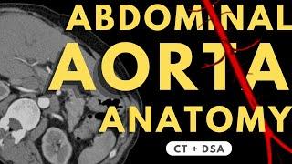 Abdominal Aorta and Branches | Radiology anatomy part 1 prep | How to read CTA + DSA