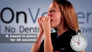 New How to Take Dental Impressions 2017 Brighter Image Lab