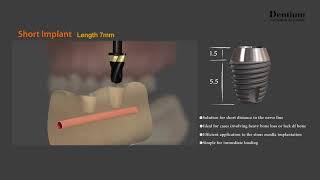 Dentium Short implant