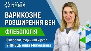 Варикозне розширення вен | Клініка ДЕНИС