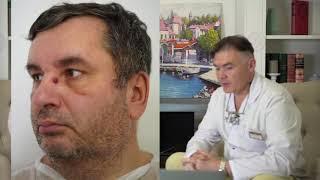 Удаление гемангиомы с одномоментной пластикой свободного кожного трансплантата. Профессор Орлов А. А