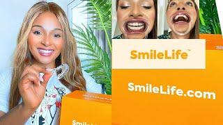 CLEAR ALIGNERS UPDATE: I'M SO HAPPY!!! (SMILELIFE) #clearaligners #dentaltransformation #smilelife