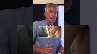 Spider Veins! Do My strategies to eliminate spider veins by eliminating visceral fat.