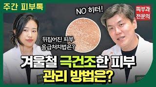 피부장벽이 무너지기 쉬운 겨울철.. 보습 및 피부 관리를 위한 꿀팁!