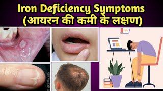 Iron Deficiency Symptoms in Hindi ( आयरन की कमी के लक्षण )