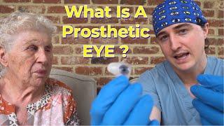 Prosthetic Eye | Explained by an Eye Surgeon