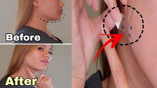 How to achieve slimmer face  instantly with no surgery | Facelift tape