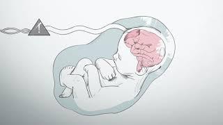 What is hypoxic ischemic encephalopathy?