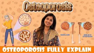 Osteoporosis fully Explained by @Dr.Sharmika | #drsharmika #rheumatoid #bodypain