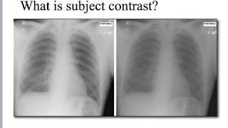 X-ray subject contrast