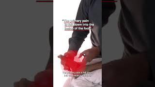 Is Your Foot Pain Linked to Tibialis Anterior Trigger Points?