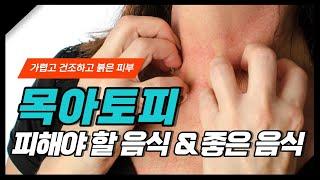 목 주름 따라 가려운 목 아토피에 좋은 음식과 피해야 할 음식, 원인 총 정리